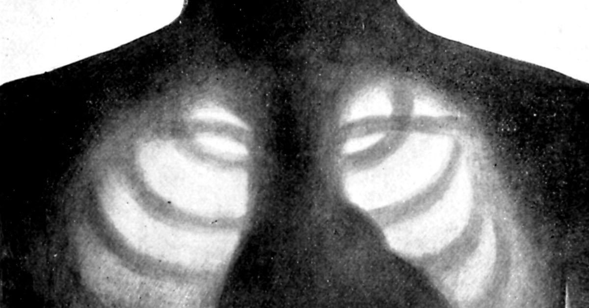 La première IA autonome d’analyse de rayons X est autorisée dans l’UE