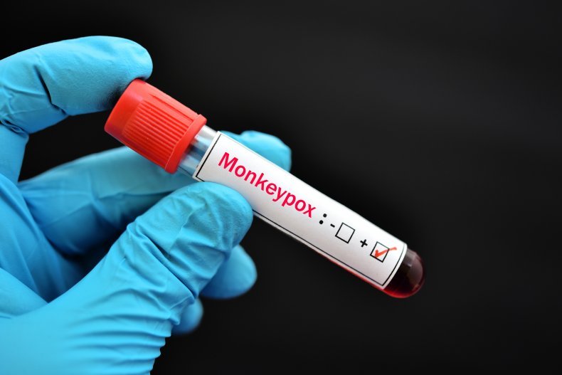 Échantillon de monkeypox