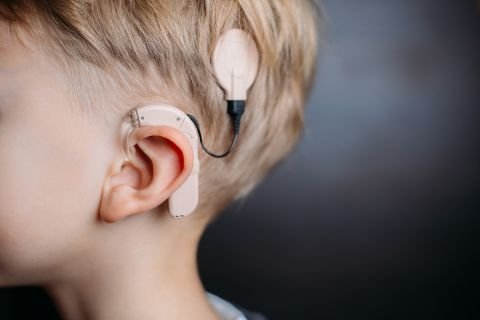 Cochlear implants can give a sense of sound to deaf people, by using electrodes to stimulate the auditory nerve. A rudimentary version was trialled in the 1950s, and the idea was further developed by Adam Kissiah, a hard-of-hearing engineer at Kennedy Space Center. He had worked on sound and vibration sensor systems for NASA in the 1970s and used his knowledge to develop the life-changing implant.
