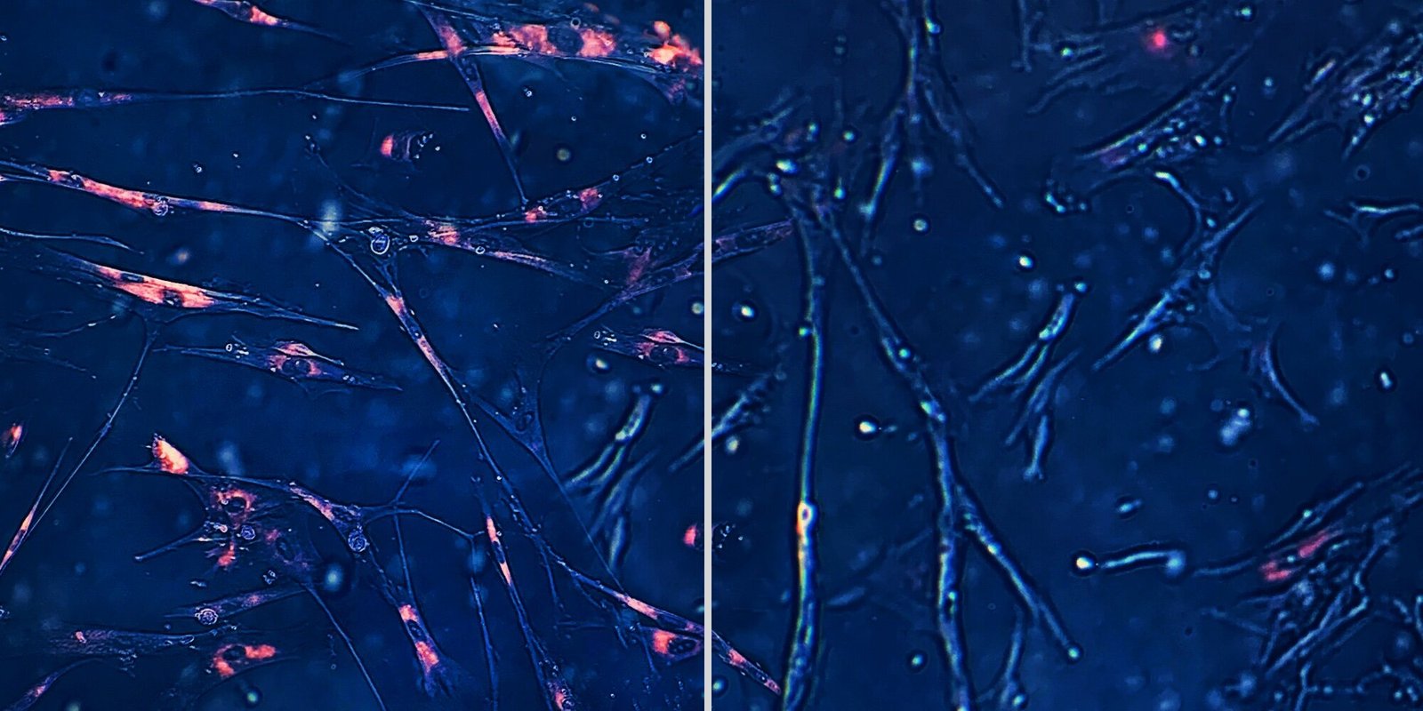 L’intelligence artificielle identifie des candidats-médicaments anti-âge ciblant les cellules «zombies»