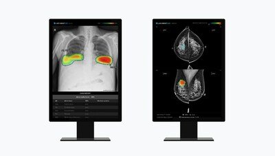 (de gauche à droite) La solution d'analyse de radiographie pulmonaire alimentée par l'IA de Lunit 