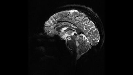 Frances CEA révèle les premières images de cerveau humain obtenues grâce à la puissante IRM mondiale 1 Frances CEA revele les premieres images de cerveau humain obtenues