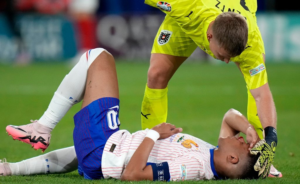 Kylian Mbapp souffre du nez cassé et a besoin d’un masque pour jouer