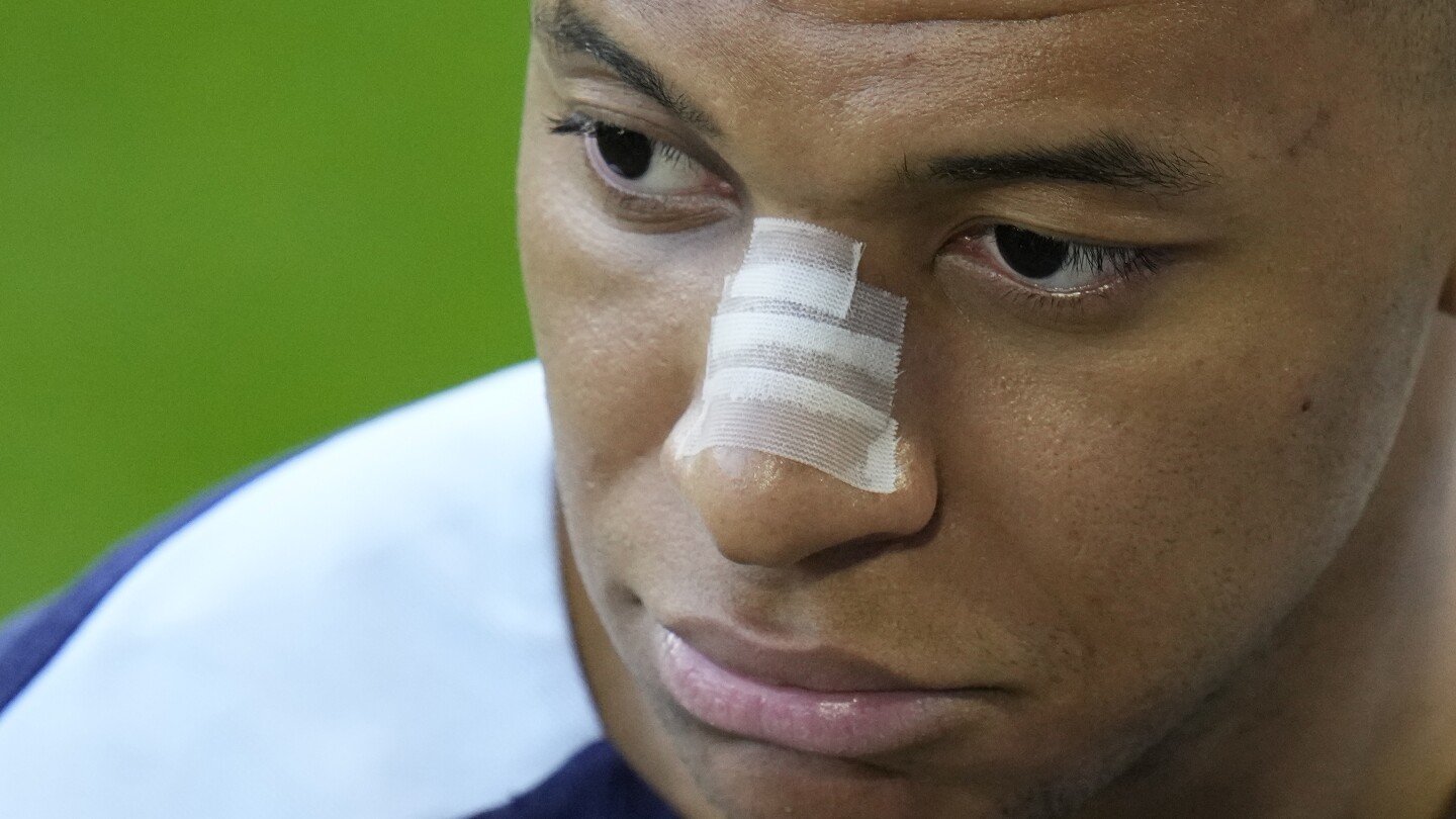 Kylian Mbappé s’entraîne à l’Euro 2024 avec un bandage sur le nez cassé et une publication sur les réseaux sociaux provoquant l’intrigue