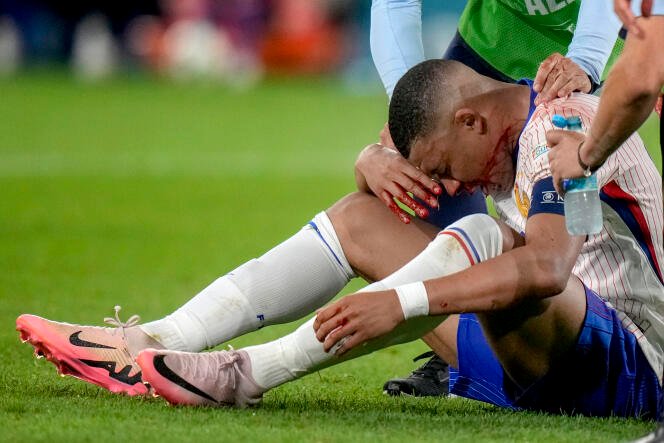 Kylian Mbappé blessé au nez lors du match de l'Euro 2024 entre la France et l'Autriche à la Merkur-Spiel Arena de Düsseldorf, le 17 juin 2024.